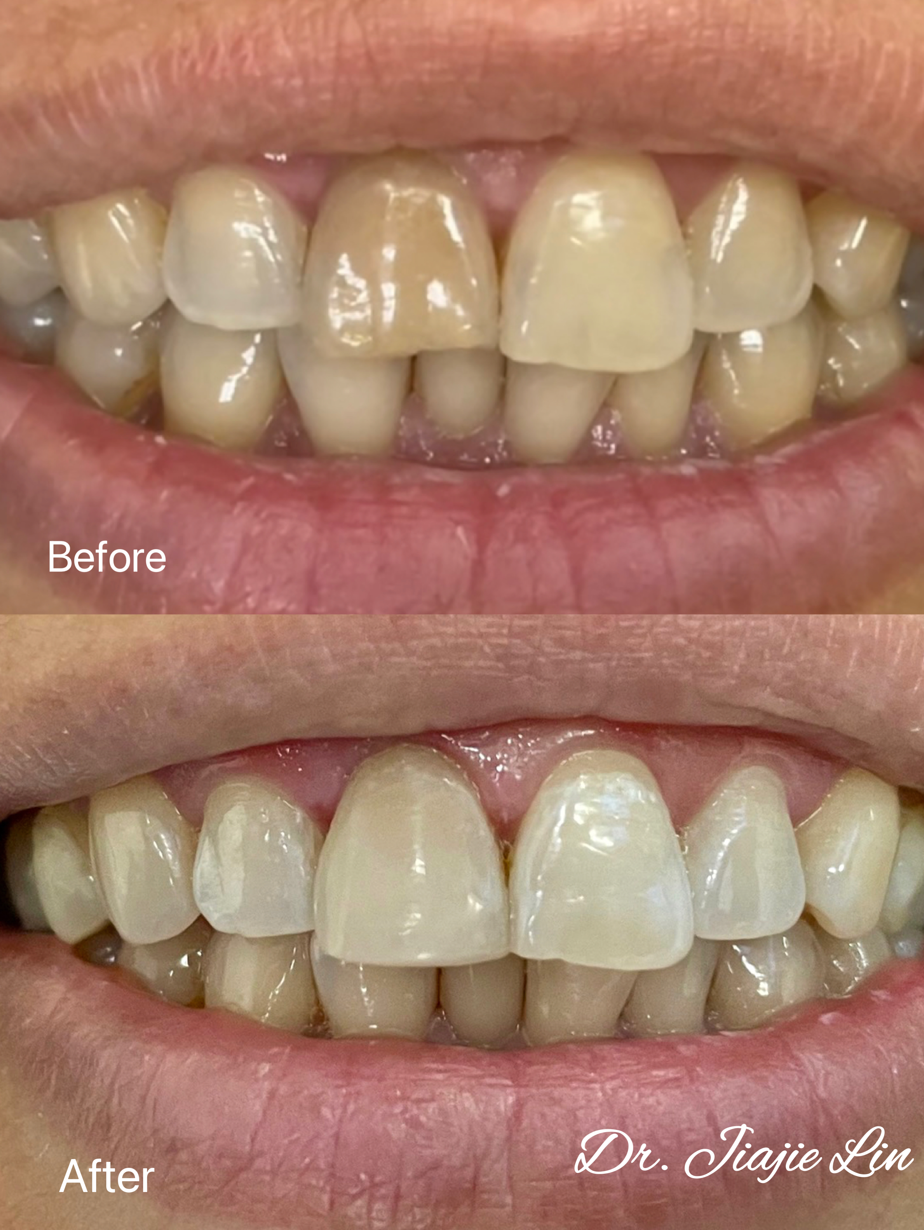 Dr Lin, Mississauga Dentist