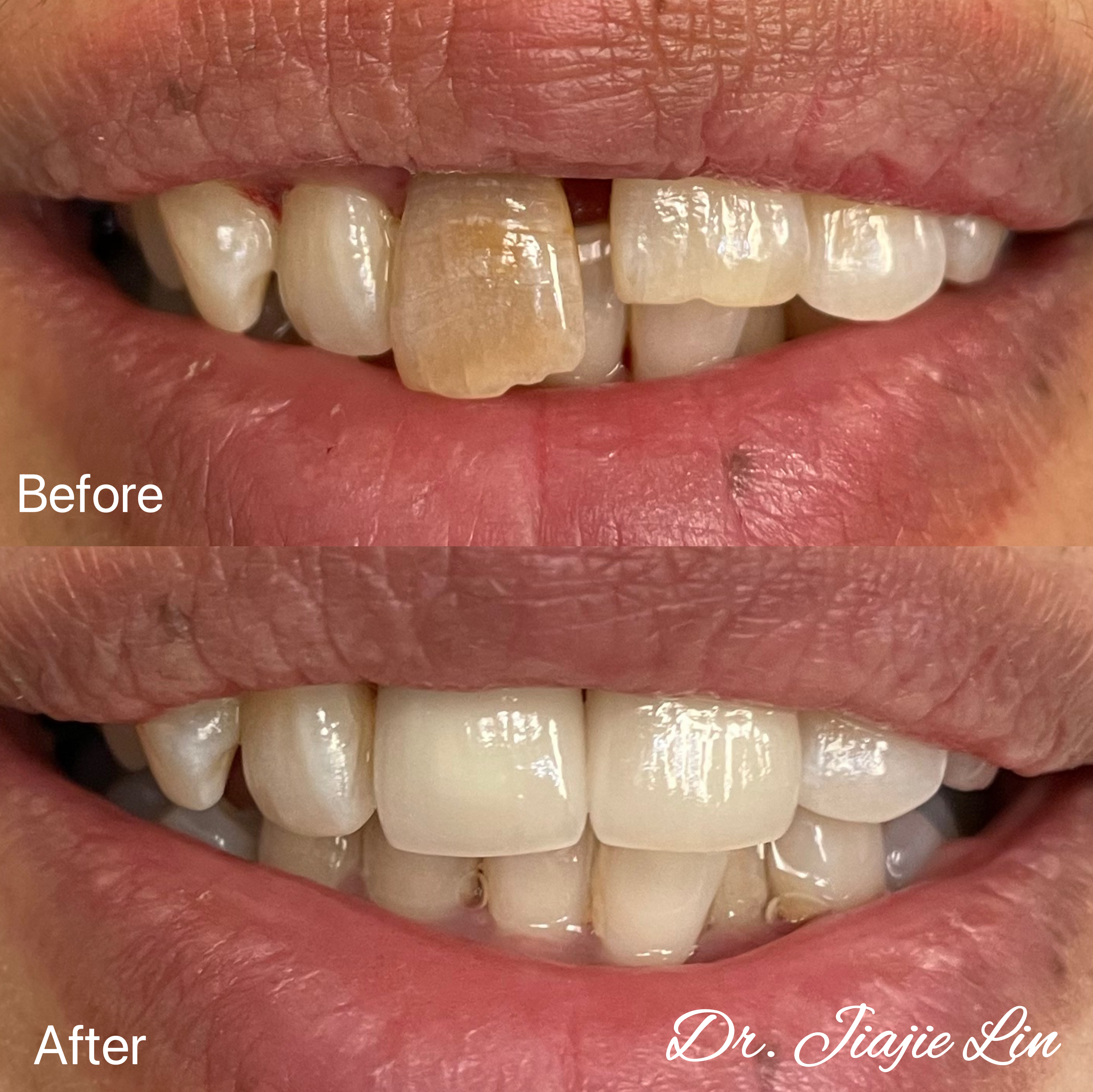 Dr Lin, Mississauga Dentist